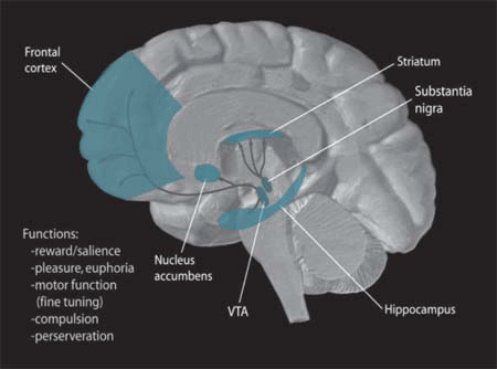 parkinsons (1)